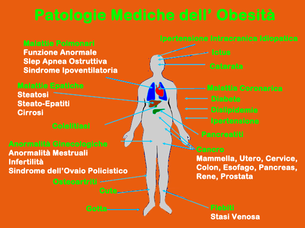 Esercizi per perdita di peso di uno stomaco e parti per ladolescente